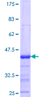 NXF3 Protein - 12.5% SDS-PAGE Stained with Coomassie Blue.