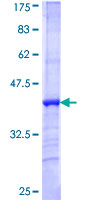 NXF5 Protein - 12.5% SDS-PAGE Stained with Coomassie Blue.