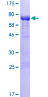 NXN Protein - 12.5% SDS-PAGE of human NXN stained with Coomassie Blue