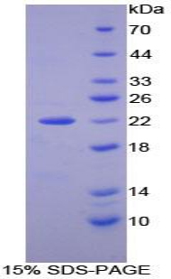 NXN Protein - Recombinant Nucleoredoxin By SDS-PAGE