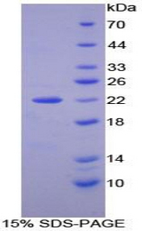 NXN Protein - Recombinant Nucleoredoxin By SDS-PAGE
