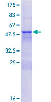 NXNL1 / TXNL6 Protein - 12.5% SDS-PAGE of human NXNL1 stained with Coomassie Blue