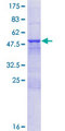 NXNL1 / TXNL6 Protein - 12.5% SDS-PAGE of human NXNL1 stained with Coomassie Blue