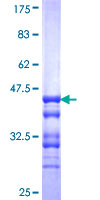 NXNL1 / TXNL6 Protein - 12.5% SDS-PAGE Stained with Coomassie Blue.