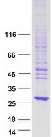 NXNL1 / TXNL6 Protein - Purified recombinant protein NXNL1 was analyzed by SDS-PAGE gel and Coomassie Blue Staining