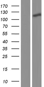 NXP2 / MORC3 Protein - Western validation with an anti-DDK antibody * L: Control HEK293 lysate R: Over-expression lysate