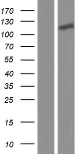 NXP2 / MORC3 Protein - Western validation with an anti-DDK antibody * L: Control HEK293 lysate R: Over-expression lysate