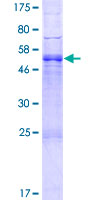NXPH1 Protein - 12.5% SDS-PAGE of human NXPH1 stained with Coomassie Blue