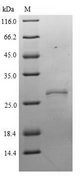 NXPH2 Protein - (Tris-Glycine gel) Discontinuous SDS-PAGE (reduced) with 5% enrichment gel and 15% separation gel.