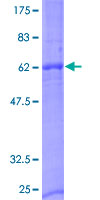 NXPH2 Protein - 12.5% SDS-PAGE of human NXPH2 stained with Coomassie Blue