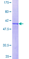 NXPH4 Protein - 12.5% SDS-PAGE of human NXPH4 stained with Coomassie Blue