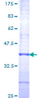 NXPH4 Protein - 12.5% SDS-PAGE Stained with Coomassie Blue.