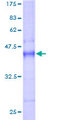 NXT1 Protein - 12.5% SDS-PAGE of human NXT1 stained with Coomassie Blue
