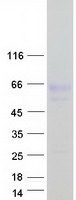 NYX Protein - Purified recombinant protein NYX was analyzed by SDS-PAGE gel and Coomassie Blue Staining