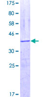 OAS1 Protein - 12.5% SDS-PAGE Stained with Coomassie Blue.