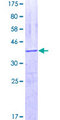 OAS1 Protein - 12.5% SDS-PAGE Stained with Coomassie Blue.