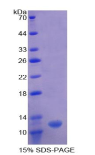 OAS1 Protein - Recombinant 2',5'-Oligoadenylate Synthetase 1 By SDS-PAGE
