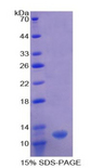 OAS1 Protein - Recombinant 2',5'-Oligoadenylate Synthetase 1 By SDS-PAGE