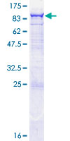 OAS2 Protein - 12.5% SDS-PAGE of human OAS2 stained with Coomassie Blue
