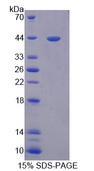 OAS2 Protein - Recombinant 2',5'-Oligoadenylate Synthetase 2 By SDS-PAGE