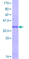 OASL Protein - 12.5% SDS-PAGE Stained with Coomassie Blue.
