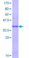 OASL Protein - 12.5% SDS-PAGE Stained with Coomassie Blue.