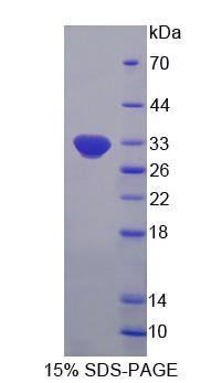 OASL Protein - Recombinant  2',5'-Oligoadenylate Synthetase Like Protein By SDS-PAGE