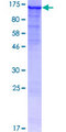 OAT Protein - 12.5% SDS-PAGE of human OAT stained with Coomassie Blue