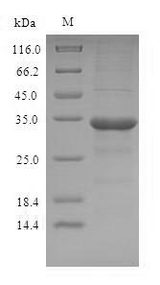 OBP2A Protein - (Tris-Glycine gel) Discontinuous SDS-PAGE (reduced) with 5% enrichment gel and 15% separation gel.