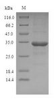 OBP2A Protein - (Tris-Glycine gel) Discontinuous SDS-PAGE (reduced) with 5% enrichment gel and 15% separation gel.