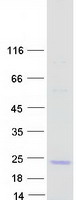 OBP2A Protein - Purified recombinant protein OBP2A was analyzed by SDS-PAGE gel and Coomassie Blue Staining