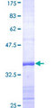 OCA2 / P protein Protein - 12.5% SDS-PAGE Stained with Coomassie Blue.