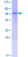 OCIAD1 Protein - 12.5% SDS-PAGE of human OCIAD1 stained with Coomassie Blue