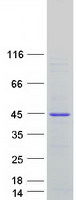 OCIAD1 Protein - Purified recombinant protein OCIAD1 was analyzed by SDS-PAGE gel and Coomassie Blue Staining