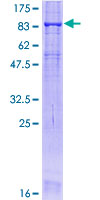 OCLN / Occludin Protein - 12.5% SDS-PAGE of human OCLN stained with Coomassie Blue