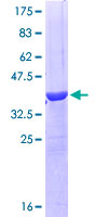 OCLN / Occludin Protein - 12.5% SDS-PAGE Stained with Coomassie Blue
