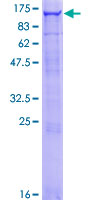OCRL Protein - 12.5% SDS-PAGE of human OCRL stained with Coomassie Blue