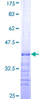 OCRL Protein - 12.5% SDS-PAGE Stained with Coomassie Blue