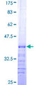 OCRL Protein - 12.5% SDS-PAGE Stained with Coomassie Blue