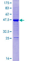 ODAM Protein - 12.5% SDS-PAGE of human ODAM stained with Coomassie Blue