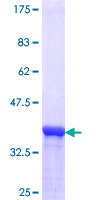 ODF2 Protein - 12.5% SDS-PAGE Stained with Coomassie Blue