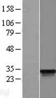 ODF3 Protein - Western validation with an anti-DDK antibody * L: Control HEK293 lysate R: Over-expression lysate