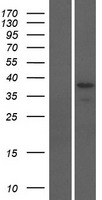 ODF3B Protein - Western validation with an anti-DDK antibody * L: Control HEK293 lysate R: Over-expression lysate