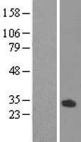 ODF3L1 Protein - Western validation with an anti-DDK antibody * L: Control HEK293 lysate R: Over-expression lysate