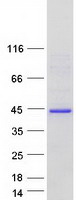 ODF3L2 Protein - Purified recombinant protein ODF3L2 was analyzed by SDS-PAGE gel and Coomassie Blue Staining