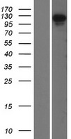 OFD1 Protein - Western validation with an anti-DDK antibody * L: Control HEK293 lysate R: Over-expression lysate
