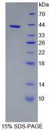 OGDH Protein - Recombinant  Oxoglutarate Dehydrogenase By SDS-PAGE