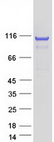 OGDH Protein - Purified recombinant protein OGDH was analyzed by SDS-PAGE gel and Coomassie Blue Staining