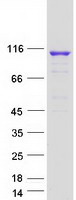 OGDHL Protein - Purified recombinant protein OGDHL was analyzed by SDS-PAGE gel and Coomassie Blue Staining