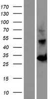 OGFOD2 Protein - Western validation with an anti-DDK antibody * L: Control HEK293 lysate R: Over-expression lysate